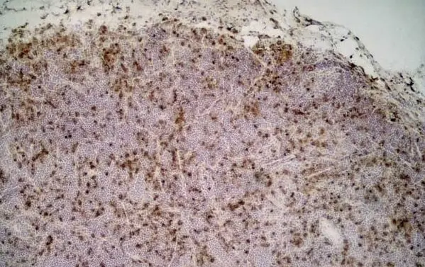 Anti Rat CD68 Antibody, clone ED1 gallery image 3
