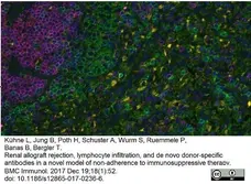 Anti Rat CD68 Antibody, clone ED1 gallery image 35