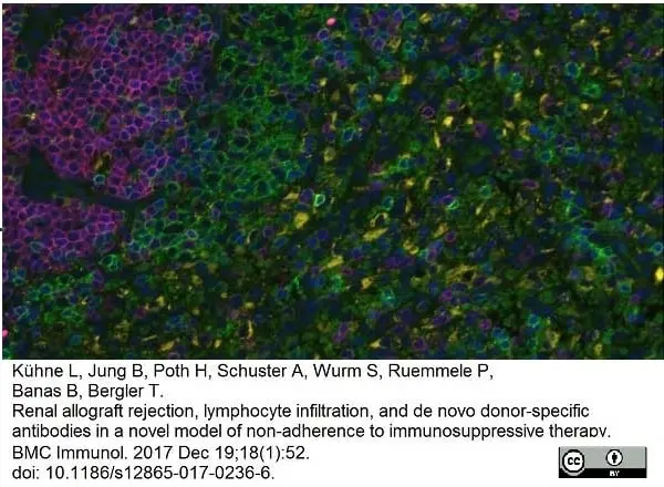 Anti Rat CD68 Antibody, clone ED1 gallery image 35