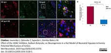 Anti Rat CD68 Antibody, clone ED1 gallery image 39