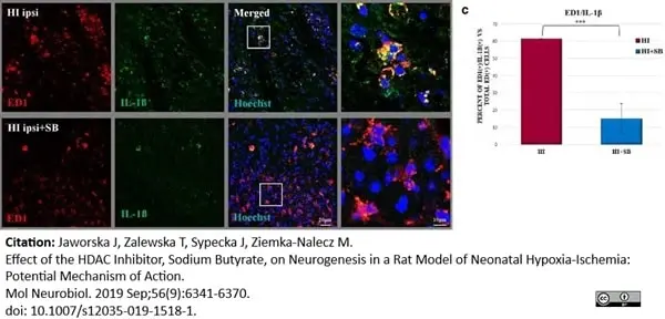 Anti Rat CD68 Antibody, clone ED1 gallery image 39