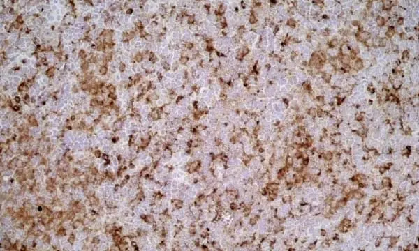 Anti Rat CD68 Antibody, clone ED1 gallery image 4