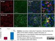 Anti Rat CD68 Antibody, clone ED1 gallery image 42
