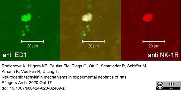 Anti Rat CD68 Antibody, clone ED1 gallery image 49