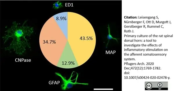 Anti Rat CD68 Antibody, clone ED1 gallery image 51