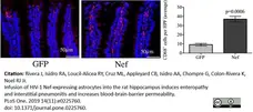 Anti Rat CD68 Antibody, clone ED1 gallery image 54