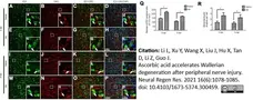 Anti Rat CD68 Antibody, clone ED1 gallery image 58