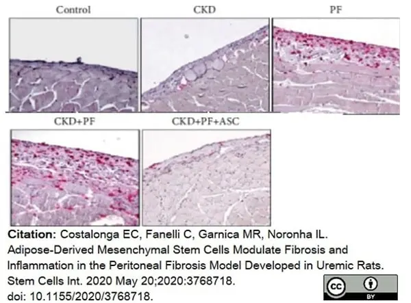 Anti Rat CD68 Antibody, clone ED1 gallery image 66