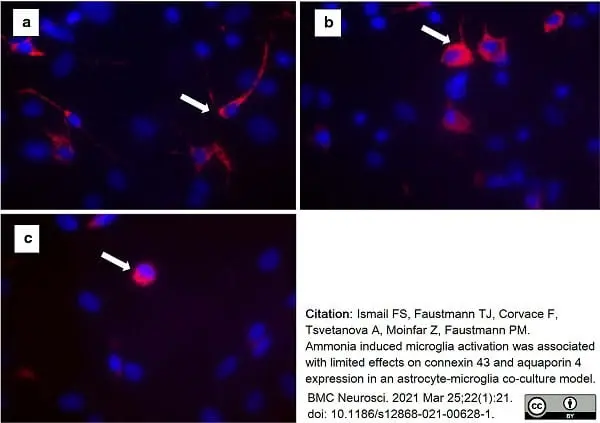 Anti Rat CD68 Antibody, clone ED1 gallery image 67
