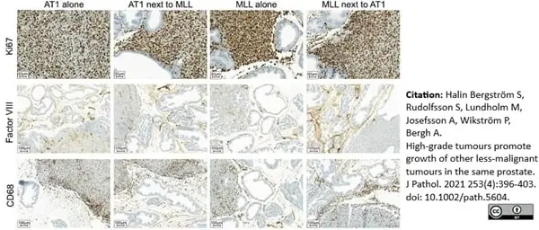 Anti Rat CD68 Antibody, clone ED1 gallery image 72