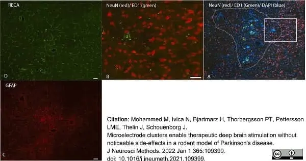 Anti Rat CD68 Antibody, clone ED1 gallery image 73