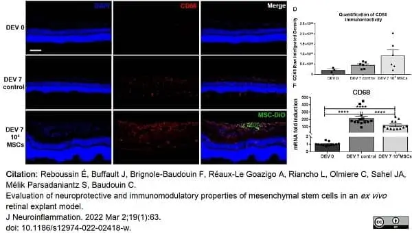 Anti Rat CD68 Antibody, clone ED1 gallery image 76