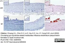 Anti Rat CD68 Antibody, clone ED1 gallery image 82