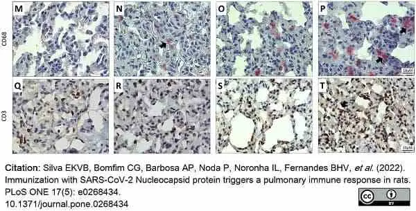 Anti Rat CD68 Antibody, clone ED1 gallery image 83
