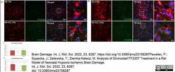 Anti Rat CD68 Antibody, clone ED1 gallery image 86