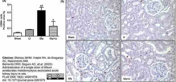 Anti Rat CD68 Antibody, clone ED1 gallery image 91