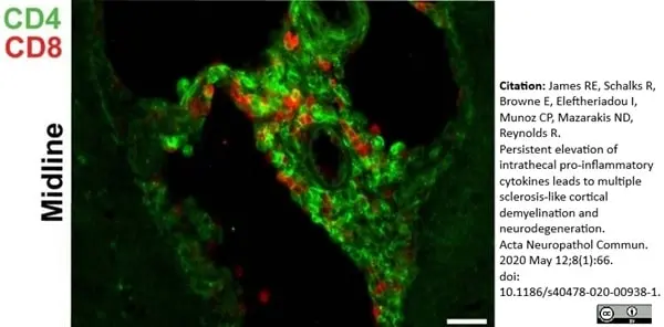 Anti Rat CD8 Alpha Antibody, clone OX-8 gallery image 13