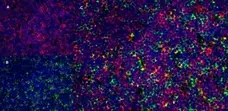 Anti Rat CD8 Alpha Antibody, clone OX-8 gallery image 6