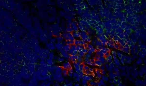 Anti Rat CD8 Alpha Antibody, clone OX-8 gallery image 8