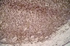 Anti Rat CD8 Beta Antibody, clone 341 gallery image 2