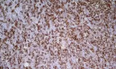 Anti Rat CD8 Beta Antibody, clone 341 gallery image 3