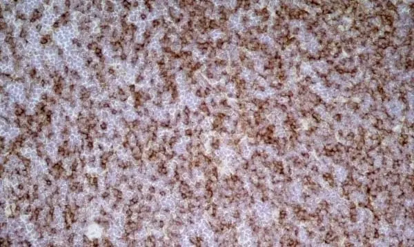Anti Rat CD8 Beta Antibody, clone 341 gallery image 3
