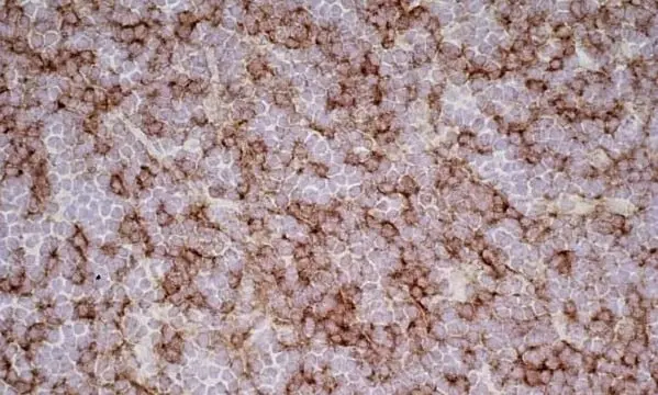 Anti Rat CD8 Beta Antibody, clone 341 gallery image 4