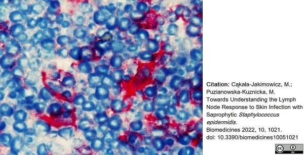 Anti Rat CD90 Antibody, clone OX-7 gallery image 4