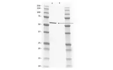 Anti Rat IgG2b Antibody, clone AbD41333 gallery image 1