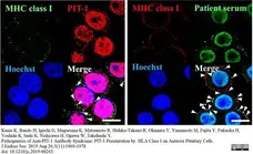 Anti Rat MHC Class I RT1A Antibody, clone OX-18 gallery image 5