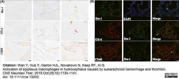 Anti Rat MHC Class II RT1B Antibody, clone OX-6 gallery image 13