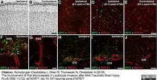Anti Rat RECA-1 Antibody, clone HIS52 gallery image 18