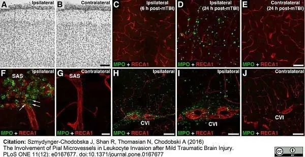 Anti Rat RECA-1 Antibody, clone HIS52 gallery image 18