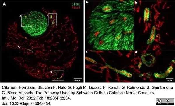 Anti Rat RECA-1 Antibody, clone HIS52 gallery image 33