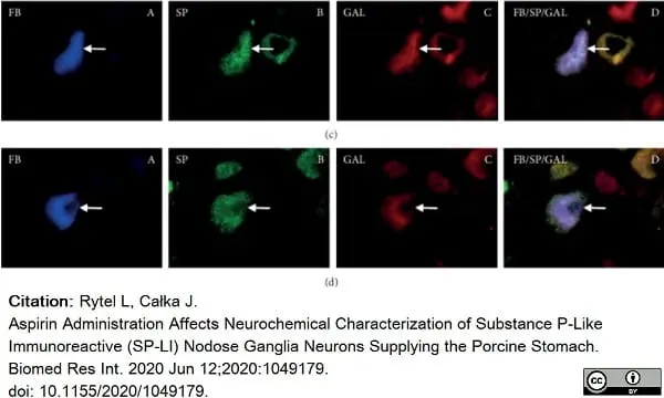 Anti Substance P Antibody, clone NC1/34 gallery image 16