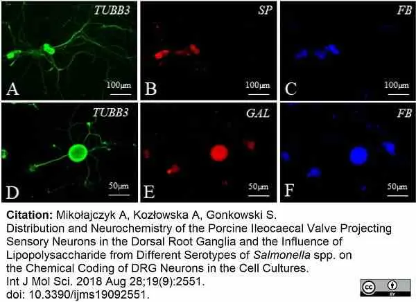 Anti Substance P Antibody, clone NC1/34 gallery image 24