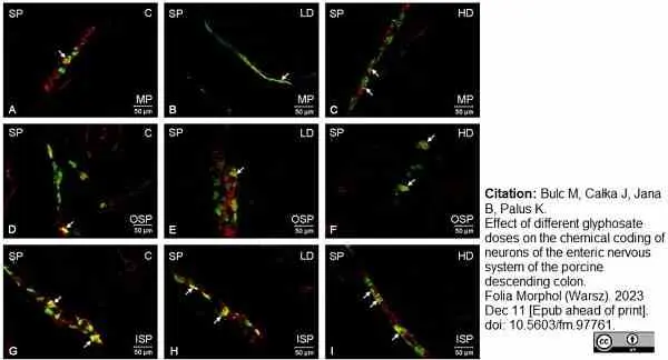 Anti Substance P Antibody, clone NC1/34 gallery image 25