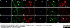 Anti Substance P Antibody, clone NC1/34 gallery image 3