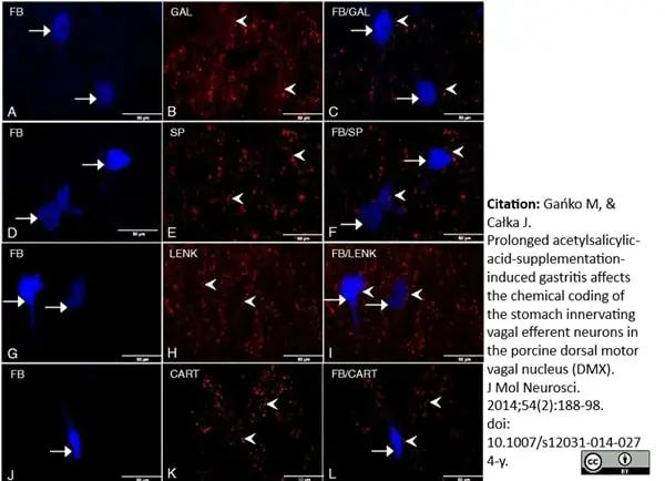 Anti Substance P Antibody, clone NC1/34 gallery image 4