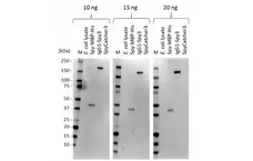 anti SpyTag Antibody, clone AbD51767kg gallery image 4
