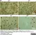 Anti Adenovirus Hexon Antibody, clone 8C4 thumbnail image 1