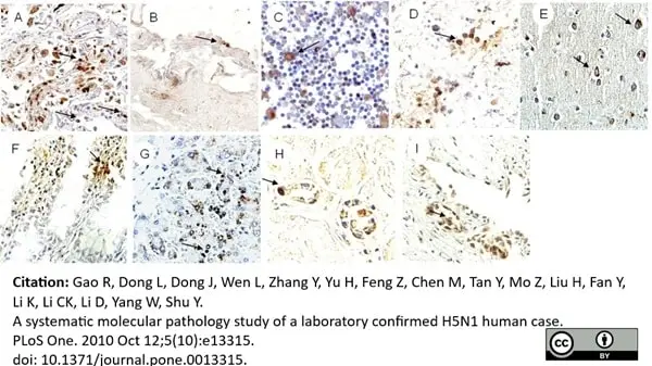 Anti Influenza A Nucleoprotein Antibody, clone AA5H gallery image 14