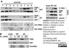 Anti Influenza B Nucleoprotein Antibody, clone B017 (B35G) gallery image 1