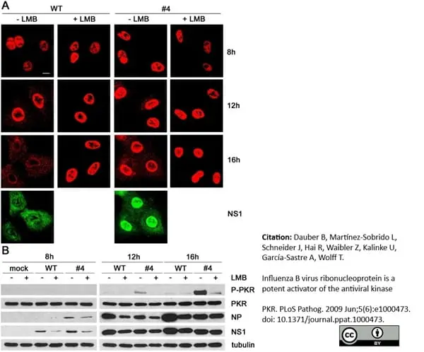 Anti Influenza B Nucleoprotein Antibody, clone B017 (B35G) gallery image 2