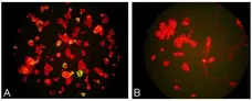 Anti Metapneumovirus Antibody, clone HMPV123 gallery image 1