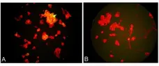 Anti Metapneumovirus Antibody, clone HMPV24 gallery image 1