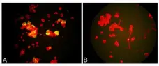 Anti Metapneumovirus Antibody, clone HMPV33 gallery image 1