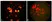 Anti Metapneumovirus Antibody, clone HMPV33 thumbnail image 1