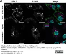 Anti Respiratory Syncytial Virus Fusion Protein Antibody, clone RSV3216 (B016) gallery image 4