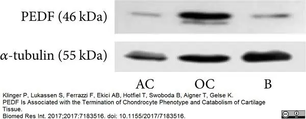 Anti Tubulin Alpha Antibody, clone YL1/2 gallery image 10